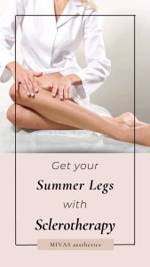 Read more about the article Spider Veins