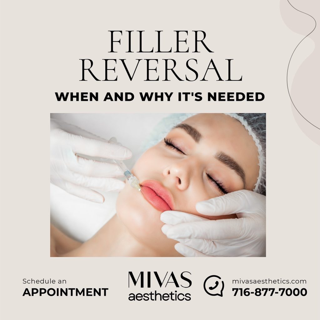 Filler Reversal When and Why It's Needed