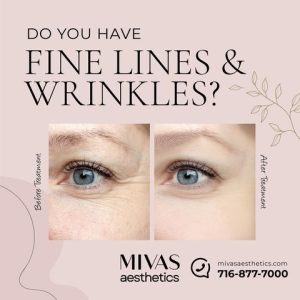 Read more about the article Fine lines and wrinkles are inevitable. Don’t let them diminish your confidence.