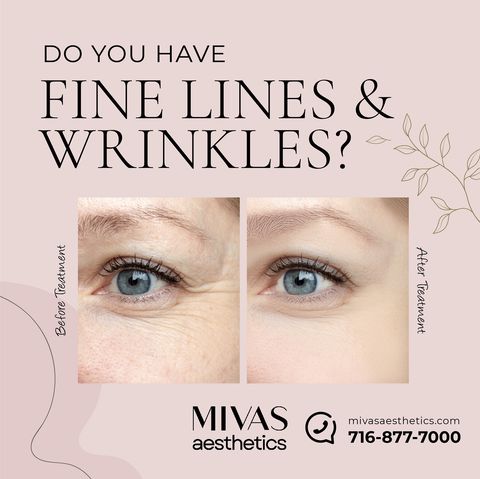 Fine lines and wrinkles are inevitable. Don’t let them diminish your confidence.