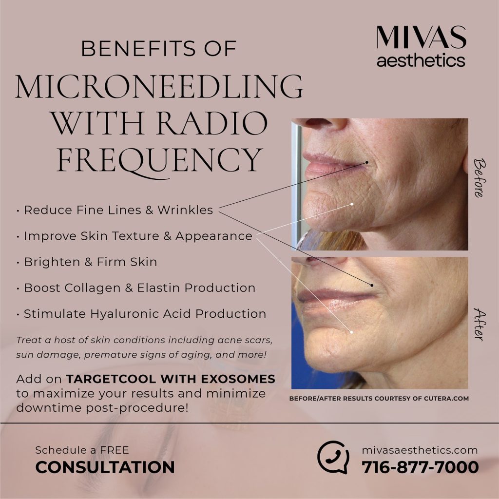 ✨ Save on All Microneedling with Radio Frequency in December! ✨