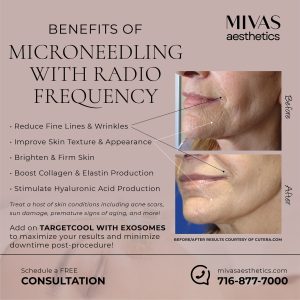 Read more about the article ✨ Save on All Microneedling with Radio Frequency in December! ✨