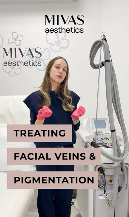 Treating Facial Veins and Pigmentation