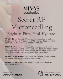 Read more about the article ✨ All about Secret RF Microneedling ✨