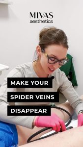Read more about the article Make Your Spider Veins Disappear