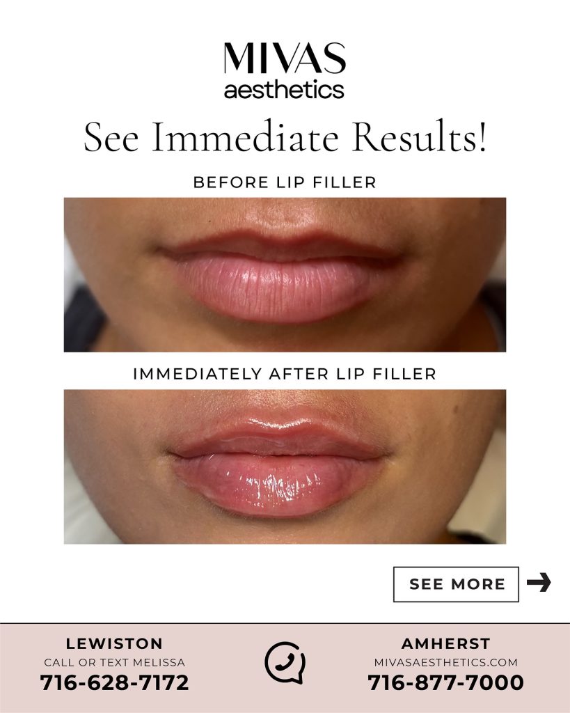 See Immediate Results