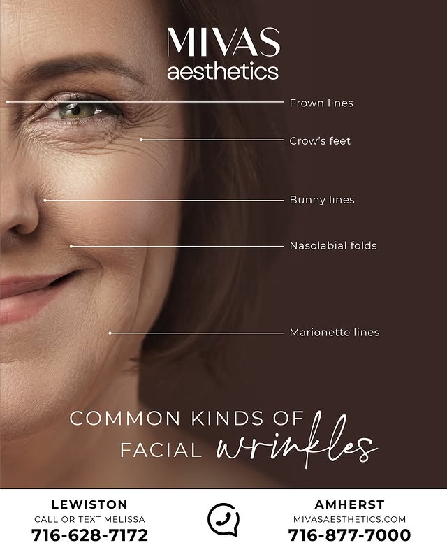 Common Kinds of Facial Wrinkles