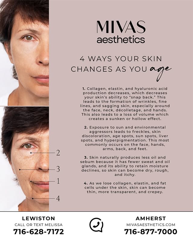 4 Ways Your Skin Changes As You Age
