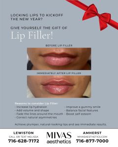 Read more about the article Give Yourself the Gift of Lip Filler