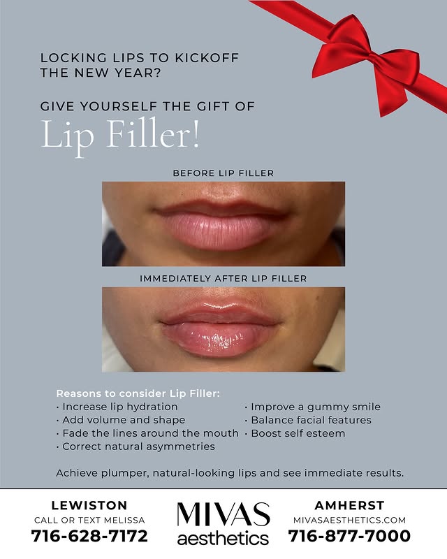 Give Yourself the Gift of Lip Filler