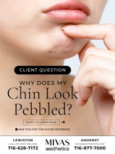 Read more about the article Client Question: Why does my chin look pebbled?